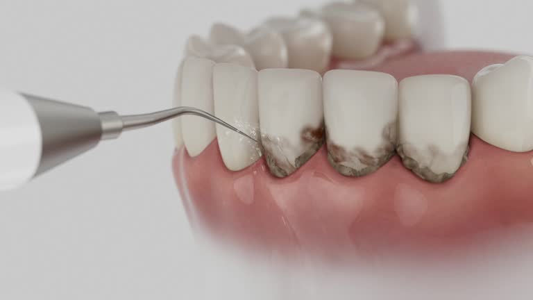 Reliable Tooth Extraction contractor in Midland, MI by Smile Center Dentistry